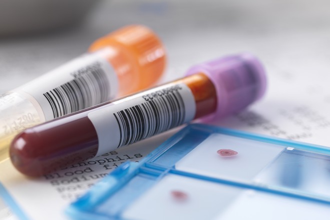 cancer blood test