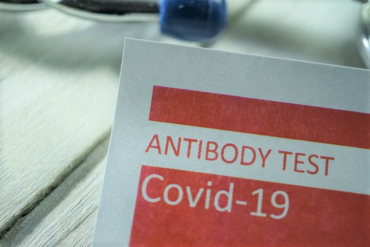 antibody test for COVID-19