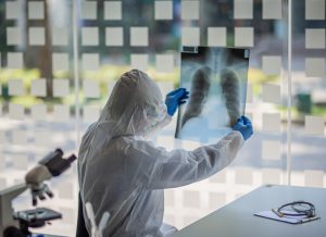 Doctor checking chest x-ray film at hospital.