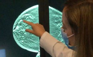 Radiologist showing breast scan