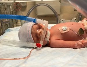 Baby Naomi in the NICU.