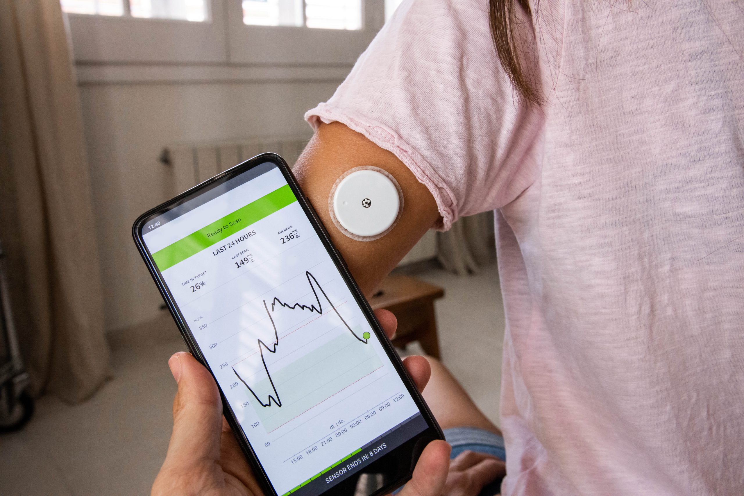 Photo of a patient using a continuous Glucose Monitoring system
