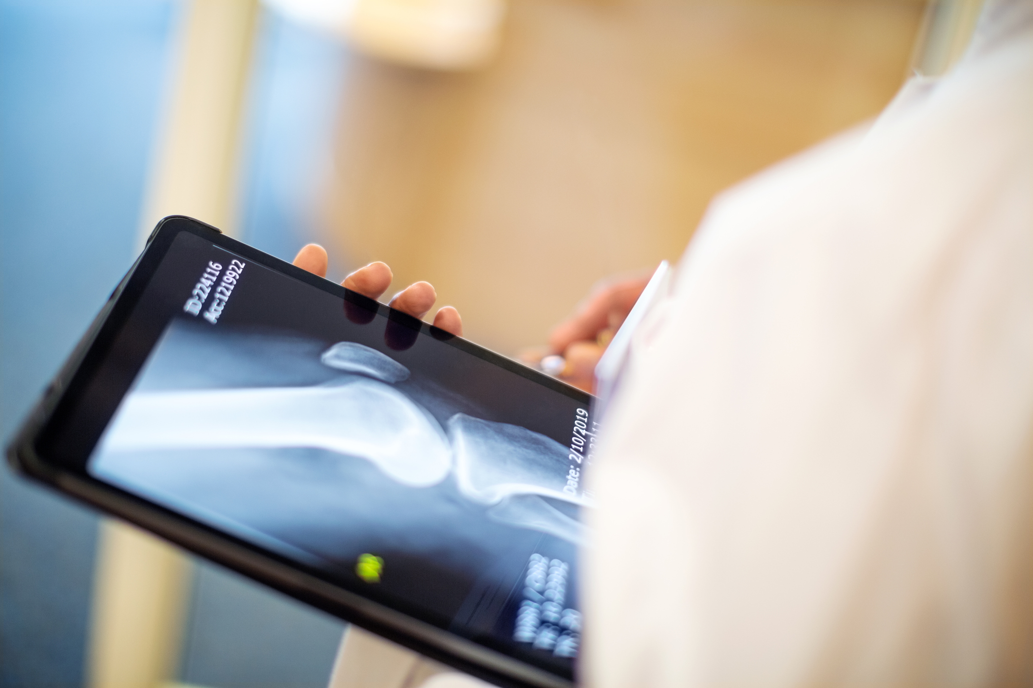 Doctor looking at a knee X-ray on a tablet