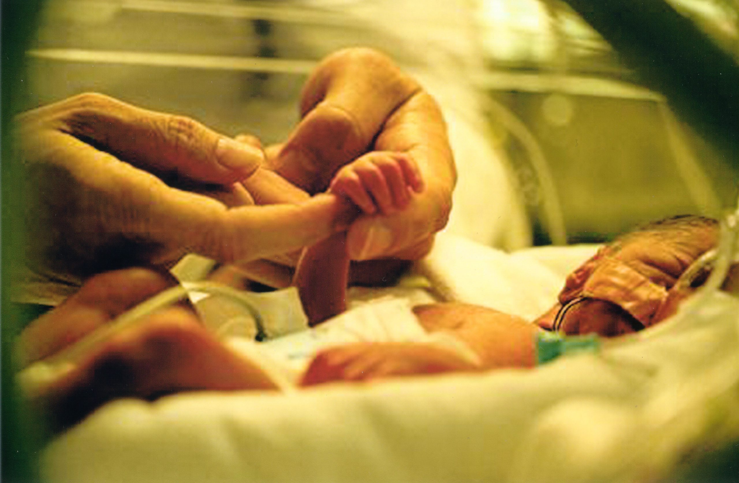 Zach McCarthy as a micro preemie in the CPMC California campus neonatal intensive care unit. An adult's hand holds Zach's tiny arm and hand up. Zach's tiny hand is just barely the size of the adult hand's fingertip. 