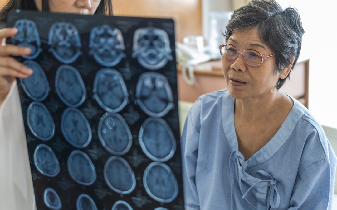 Artificial Intelligence Helps Create Leading-Edge Stroke Care