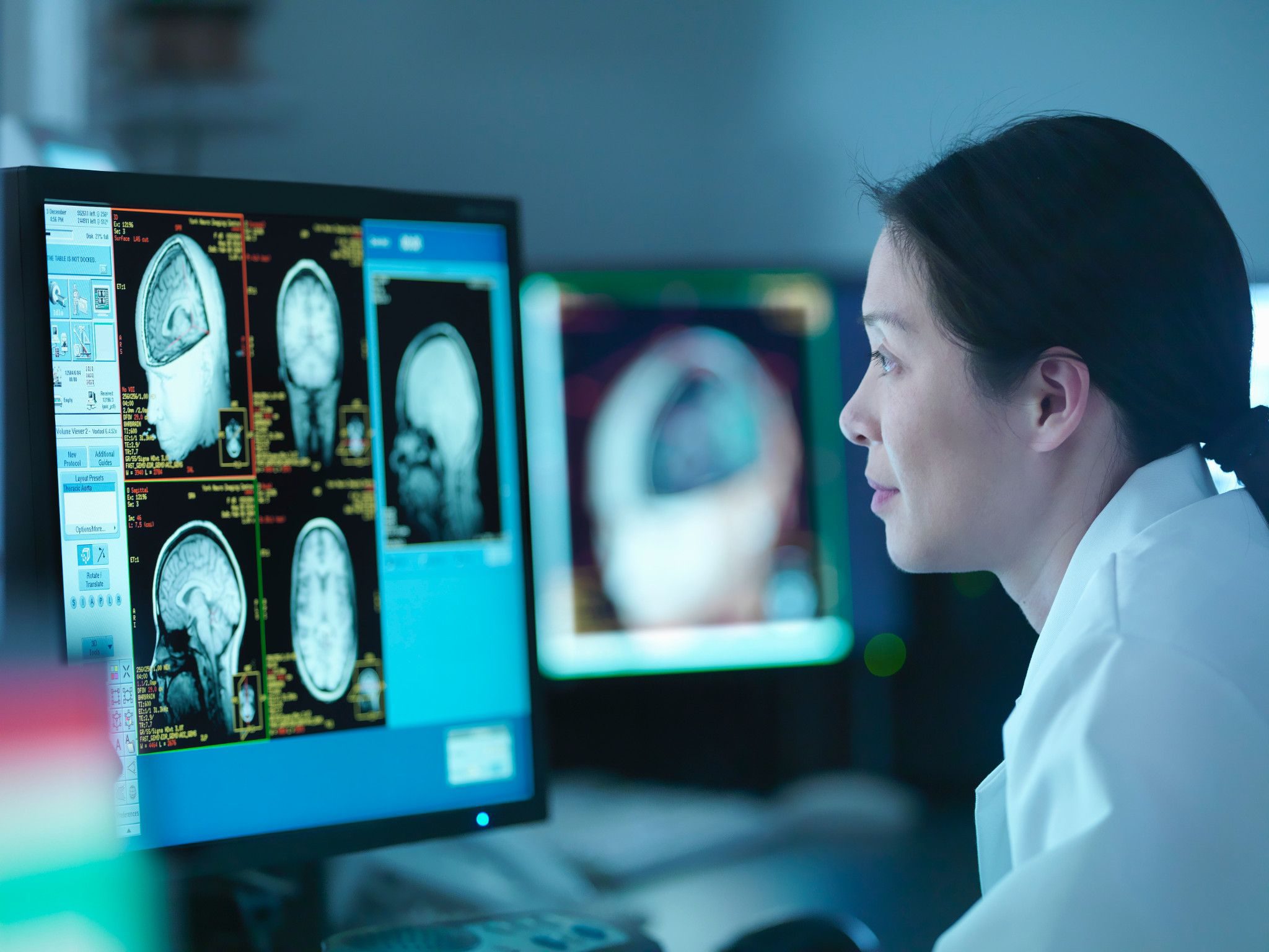 Asian doctor looking at computer monitor looking at an MRI scan to help make a diagnosis