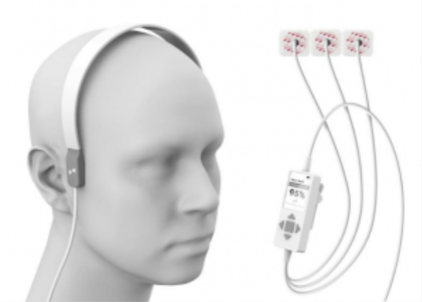 Rendering of device that looks like headphones with wires on a head