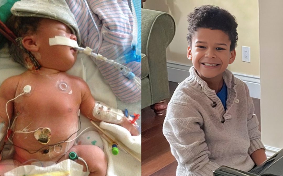 What’s ECMO? Boy’s Story Illustrates ‘Ultimate Life-Saving Tool’