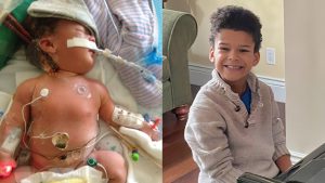 sick baby on ecmo in hospital, left, and boy playing piano