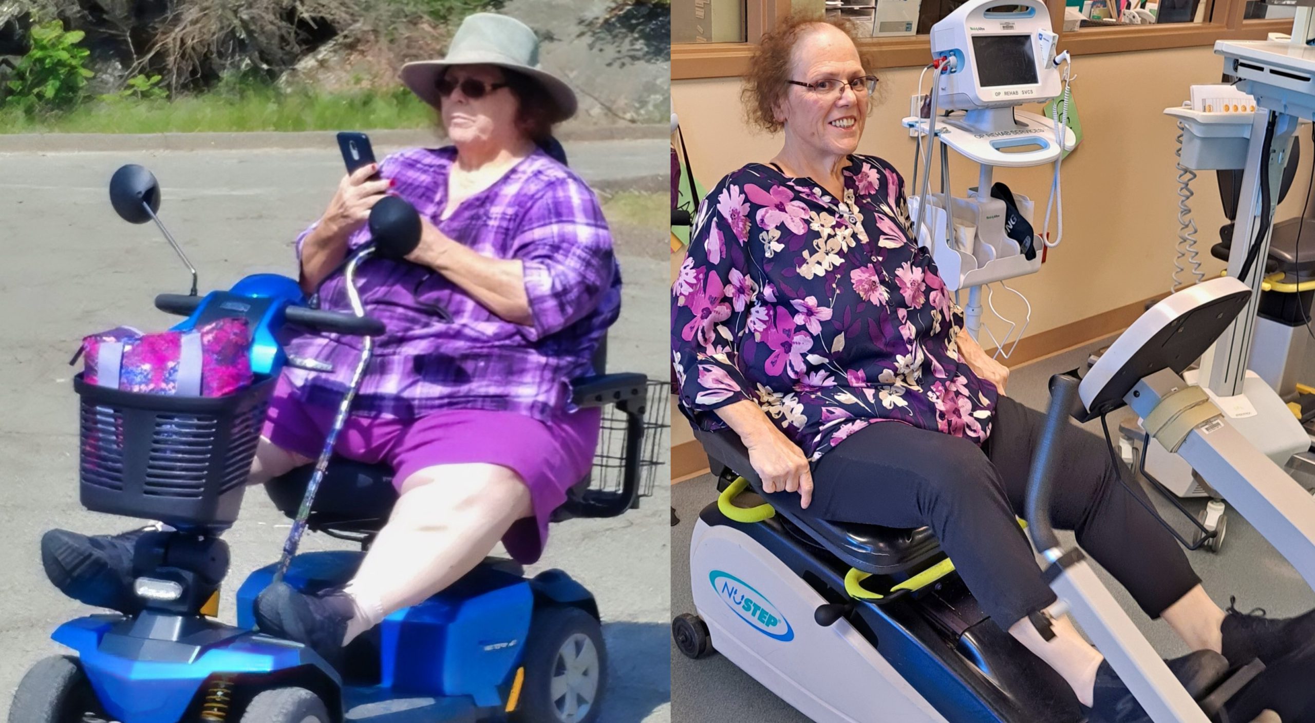Patient before and after losing 195 pounds