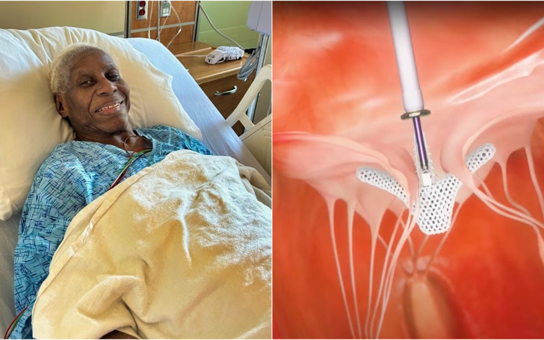 Oakland Woman Turning 90 Gets Heart Repaired in Bay First