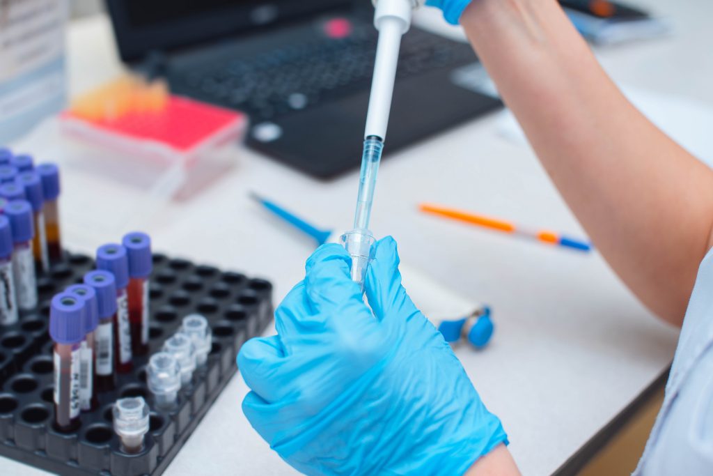 Blood test being performed in a lab