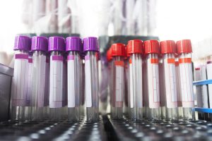 Image of empty vials for blood, purple and red color coded