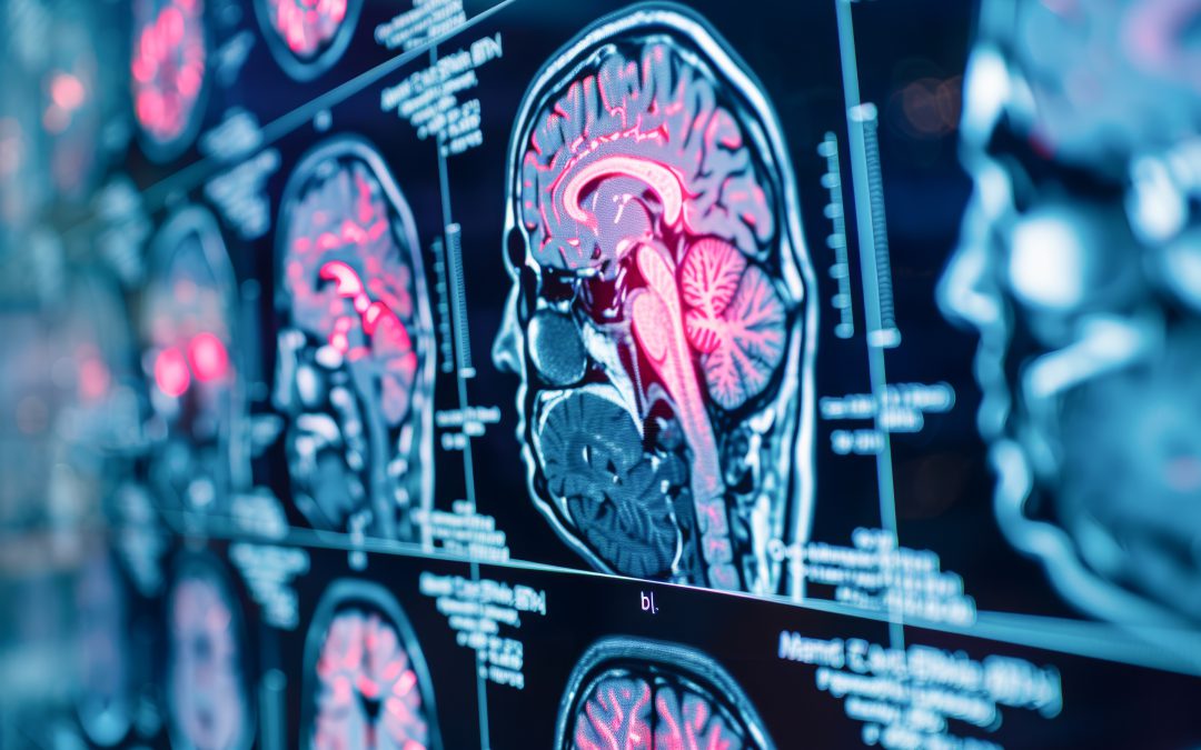 Sutter Health and Aidoc Team Up to Transform Patient Care with Advanced Clinical AI