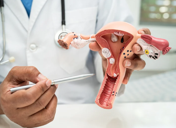 Image of a doctor holding up a uterine model