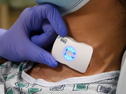 Sutter Health Hospitals Deploy Wearable Ultrasound Tech to Personalize Fluid Management for Sepsis