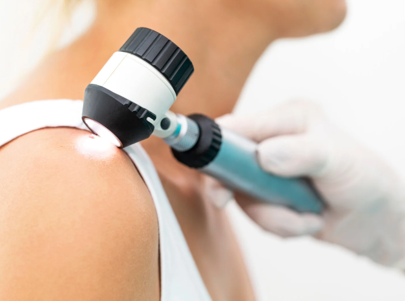 women getting her skin examined by doctor