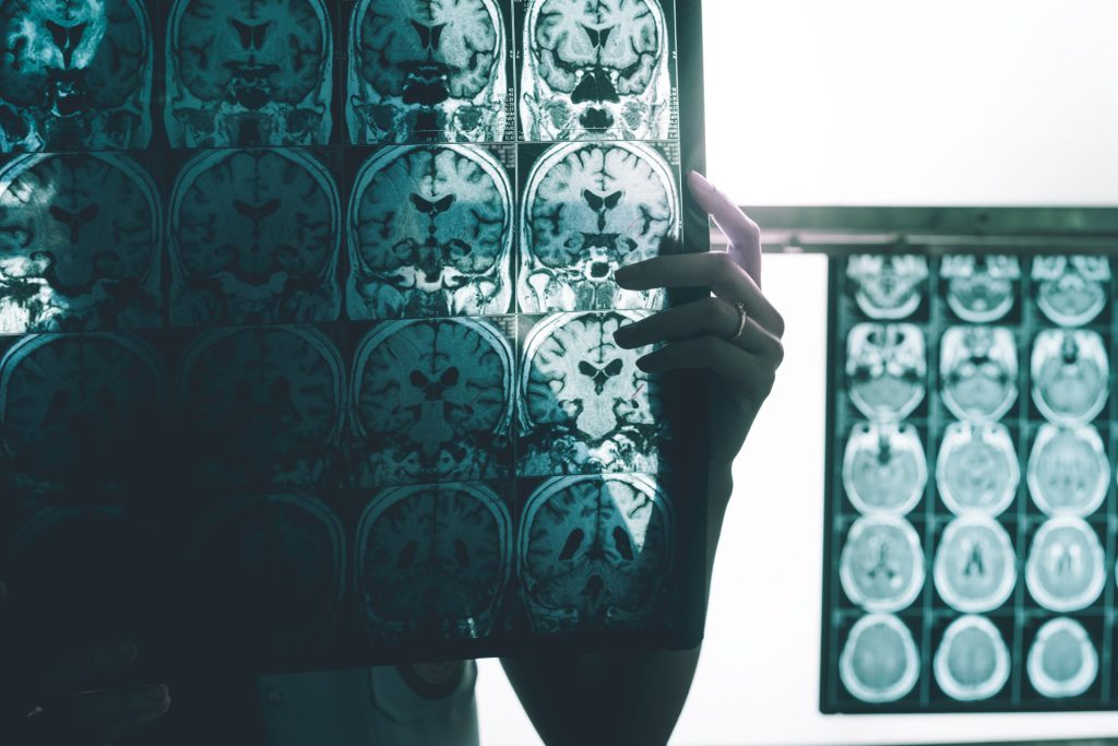 Brain mapping scan visual, someone holding a map