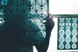 Brain mapping scan visual, someone holding a map