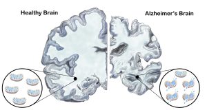 image of a brain mapping, hand drawn