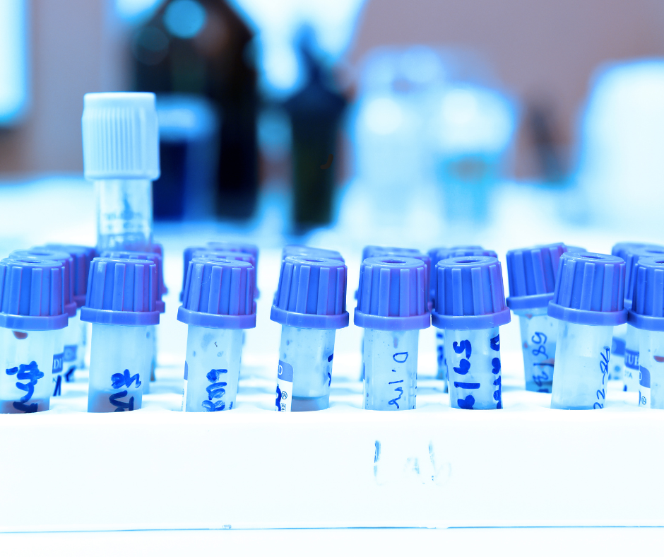 Image of blood test lined up with caps