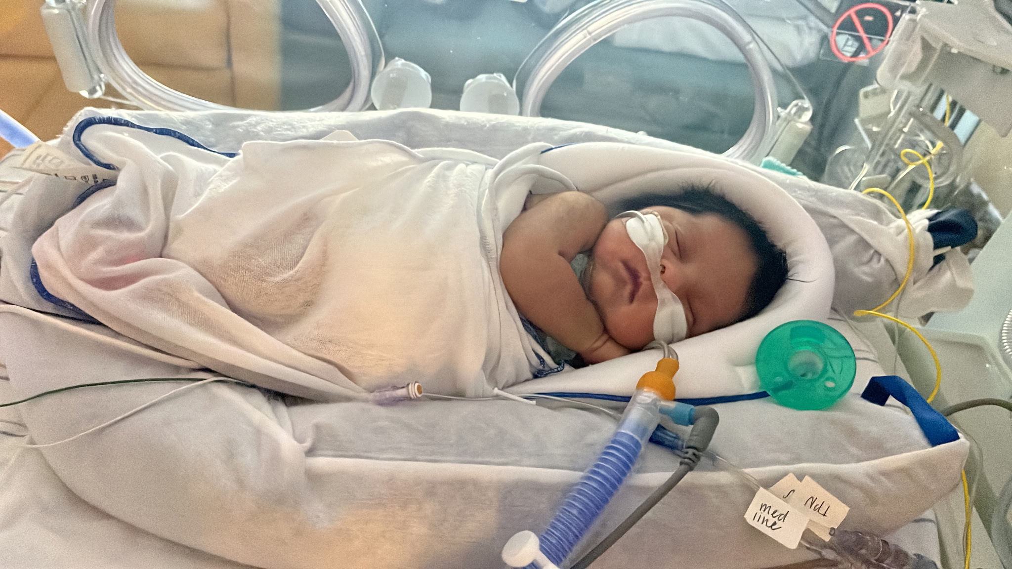 A newborn in the NICU