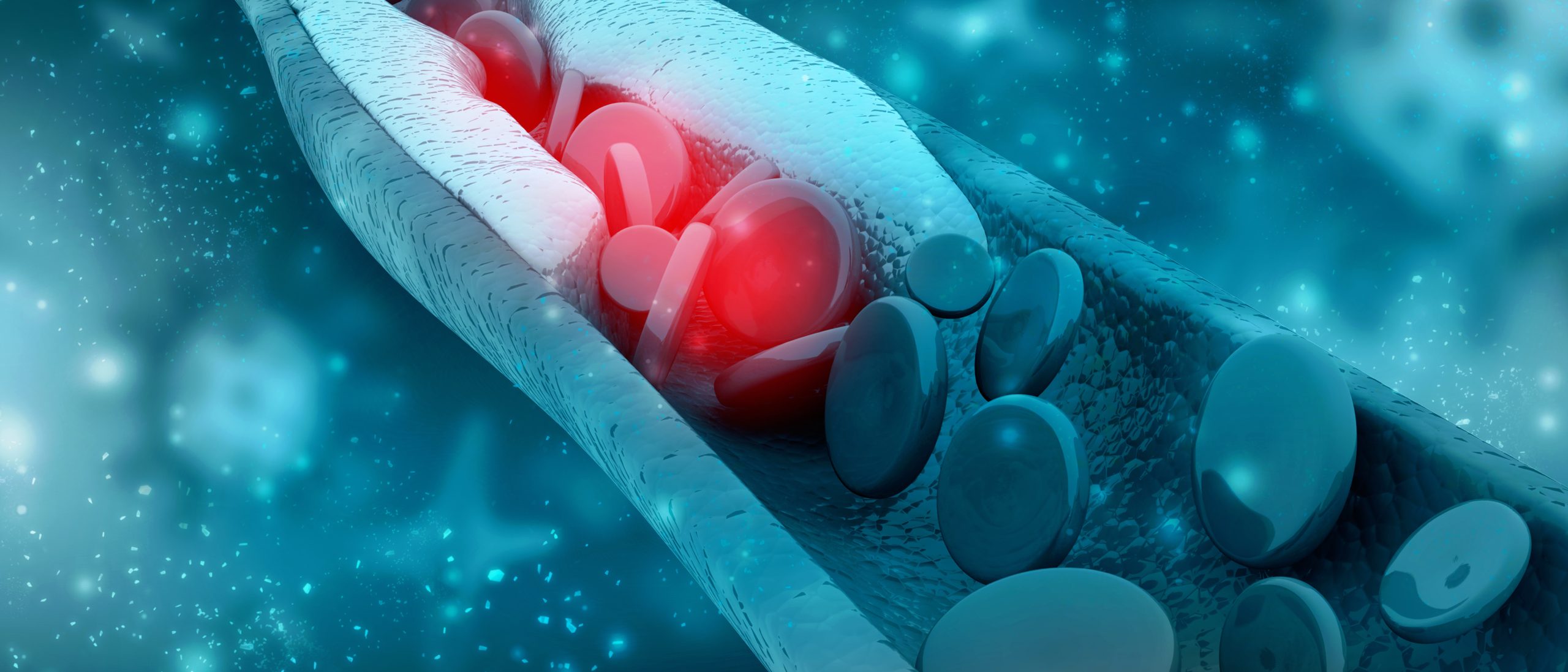 3D rendering of plaque buildup in artery 3d rendering blood cells with plaque buildup