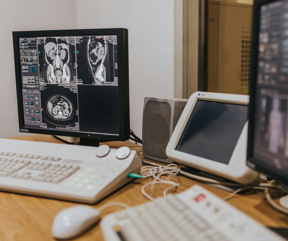 Image of computers, white keyboards, radiology station