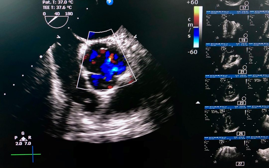 Sutter Health Earns Top Heart Imaging Accreditation