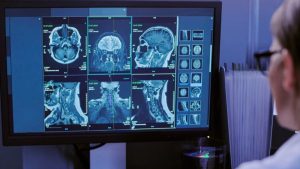 Physician examines scans of the brain