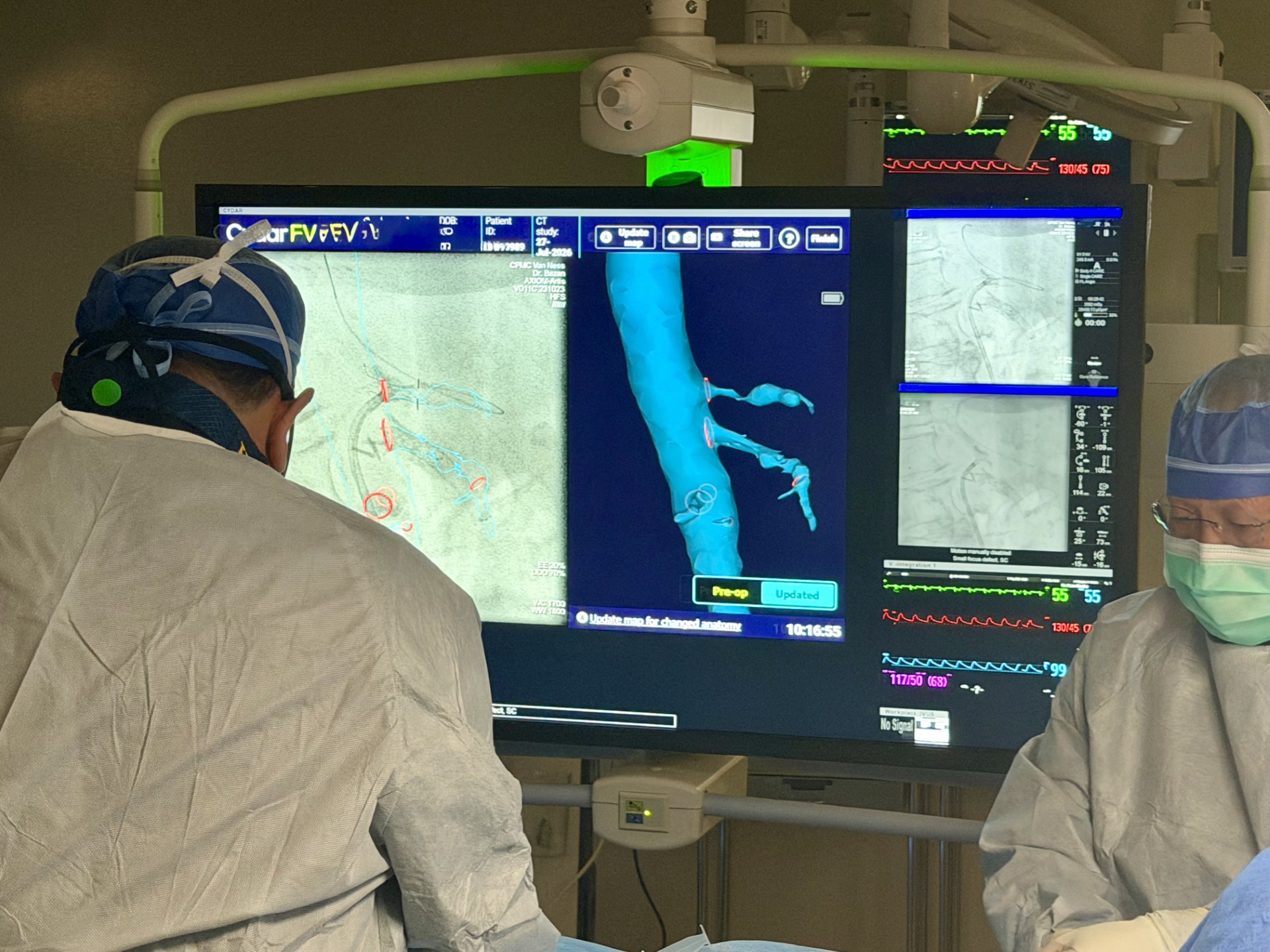Cydar AI Fusion Screen A surgeon uses advanced imaging for a patient's acute-on-chronic mesenteric ischemia
