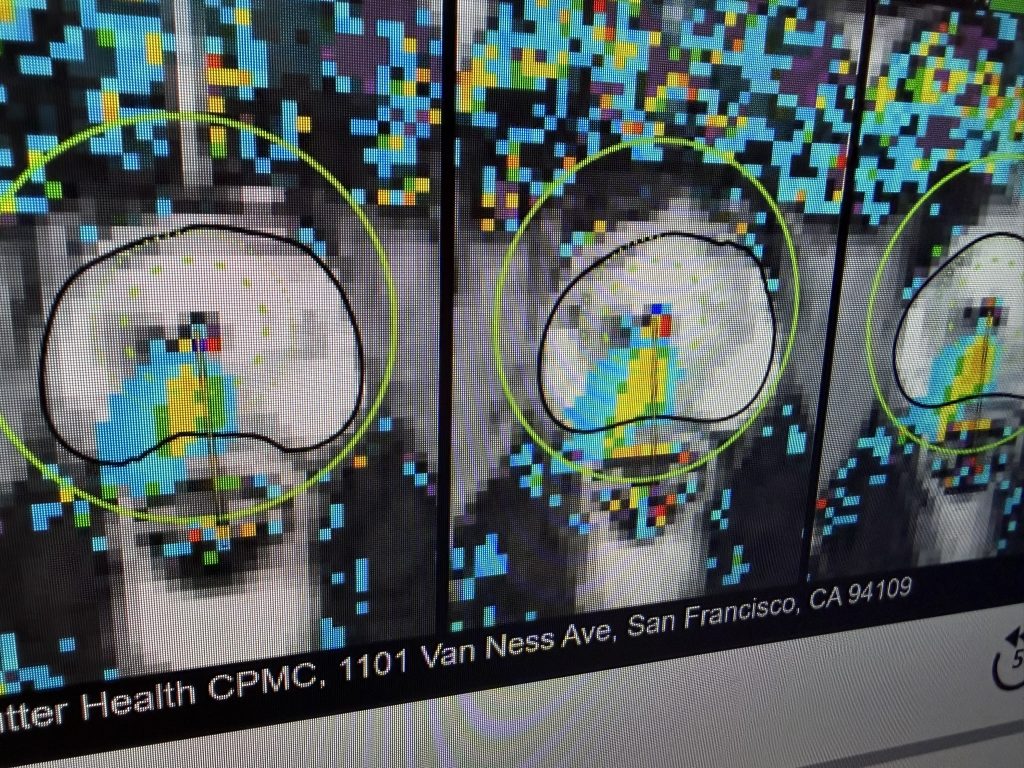 Scan of a prostate