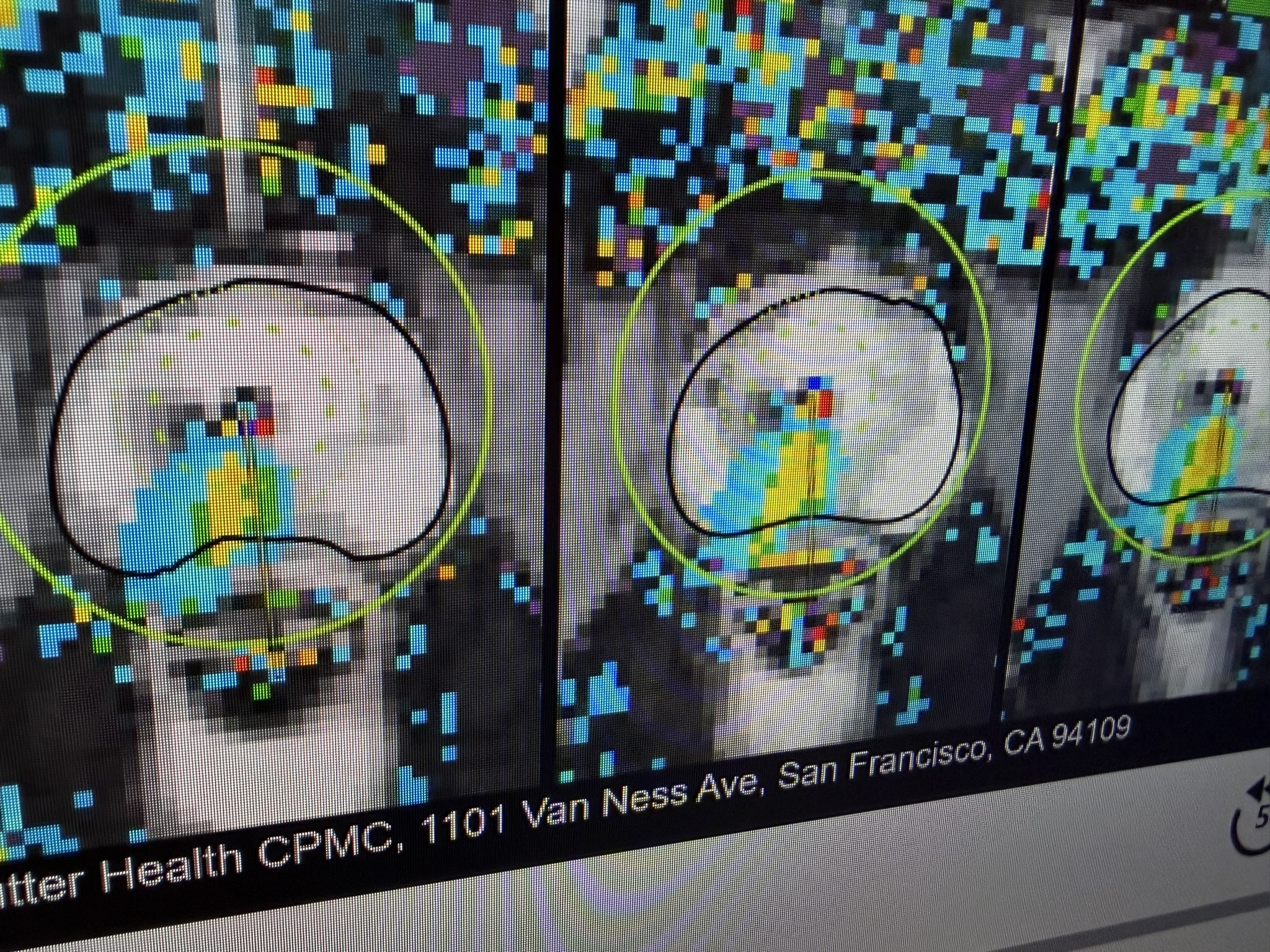 Scan of a prostate